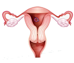 Spermatorrhoea